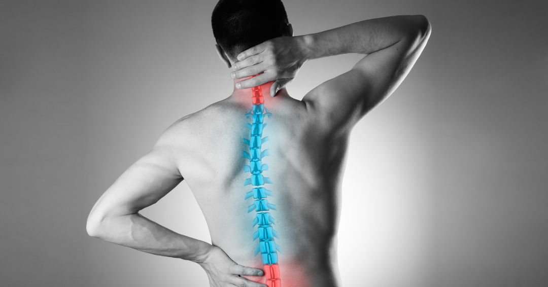 Physiotherapy Management of Osteoporosis